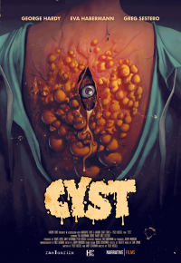 Cyst streaming