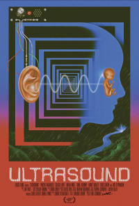 Ultrasound streaming